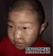 为了让孩子成名，我在脸上给了他200次点击，现