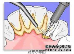 定期清洁牙齿的6种方法