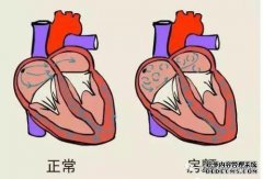 心脏ST段改变的意义和作用是什么？