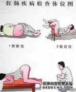 哪些药物可擦治肛周脓肿？最好有镇痛作用...