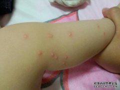 在七月和八月，小牛发红，皮肤光滑，无痛和过
