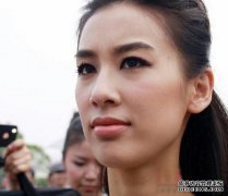 大S领怎么了？眼睛隐隐作痛，透明的脖子被吓到