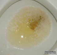 [尿液中的脂肪怎么回事？]